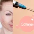 The Ultimate Guide to Collagen Injections for Radiant Skin